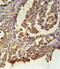 ACTH receptor antibody, LS-C164069, Lifespan Biosciences, Immunohistochemistry frozen image 