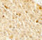 TATA-Box Binding Protein Associated Factor 9 antibody, 7719, ProSci, Immunohistochemistry paraffin image 
