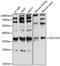 Sulfotransferase Family 1C Member 4 antibody, LS-C750403, Lifespan Biosciences, Western Blot image 