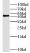 Sphingosine kinase 1 antibody, FNab08174, FineTest, Western Blot image 