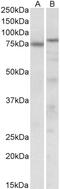 DT-diaphorase antibody, 42-451, ProSci, Western Blot image 