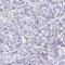 IGF Like Family Member 1 antibody, HPA014001, Atlas Antibodies, Immunohistochemistry paraffin image 