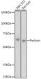 Perforin 1 antibody, GTX64408, GeneTex, Western Blot image 