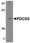 STE20/SPS1-related proline-alanine-rich protein kinase antibody, A02516-2, Boster Biological Technology, Western Blot image 