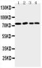 Arachidonate 12-lipoxygenase, 12S-type antibody, PA1485, Boster Biological Technology, Western Blot image 