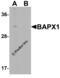 NK3 Homeobox 2 antibody, 6211, ProSci, Western Blot image 