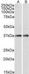 Ras antibody, orb11164, Biorbyt, Western Blot image 
