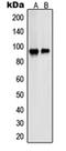 Proteasome 26S Subunit, Non-ATPase 2 antibody, orb214467, Biorbyt, Western Blot image 