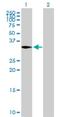 Capping Actin Protein Of Muscle Z-Line Subunit Alpha 2 antibody, H00000830-B01P, Novus Biologicals, Western Blot image 