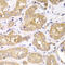 Ribosomal Protein S4 X-Linked antibody, 22-444, ProSci, Immunohistochemistry paraffin image 