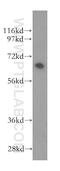 Bridging Integrator 1 antibody, 14647-1-AP, Proteintech Group, Western Blot image 