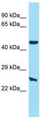 Magnesium transporter NIPA4 antibody, TA332160, Origene, Western Blot image 