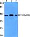 Keratin 18 antibody, PA5-36662, Invitrogen Antibodies, Western Blot image 