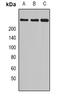 Furin, Paired Basic Amino Acid Cleaving Enzyme antibody, orb378067, Biorbyt, Western Blot image 
