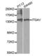 Integrin Subunit Alpha V antibody, abx001703, Abbexa, Western Blot image 