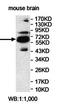 Centrosomal Protein 170B antibody, orb78172, Biorbyt, Western Blot image 