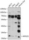 Aldo-Keto Reductase Family 1 Member D1 antibody, 23-884, ProSci, Western Blot image 