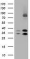 Quinolinate Phosphoribosyltransferase antibody, TA501526S, Origene, Western Blot image 