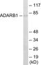 Adenosine Deaminase RNA Specific B1 antibody, EKC1764, Boster Biological Technology, Western Blot image 