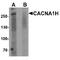 Calcium Voltage-Gated Channel Subunit Alpha1 H antibody, TA349119, Origene, Western Blot image 