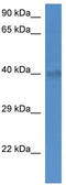 Solute Carrier Family 25 Member 27 antibody, TA333972, Origene, Western Blot image 