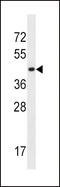 Monocarboxylate transporter 10 antibody, 56-938, ProSci, Western Blot image 