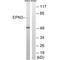Epsin-3 antibody, A12667, Boster Biological Technology, Western Blot image 