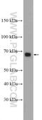 RANGAP1 antibody, 11102-1-AP, Proteintech Group, Western Blot image 