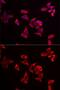 Ribosomal Protein L9 antibody, GTX55785, GeneTex, Immunofluorescence image 