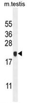Chromosome 4 Open Reading Frame 46 antibody, AP50637PU-N, Origene, Western Blot image 