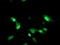 Ring Finger Protein 113B antibody, TA504118, Origene, Immunofluorescence image 