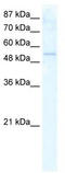 DEAD-Box Helicase 19A antibody, TA341606, Origene, Western Blot image 