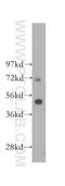 Long-chain fatty acid transport protein 4 antibody, 11013-1-AP, Proteintech Group, Western Blot image 
