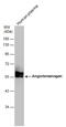 Angiotensinogen antibody, GTX103824, GeneTex, Western Blot image 