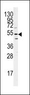 Beclin 1-associated autophagy-related key regulator antibody, LS-C156740, Lifespan Biosciences, Western Blot image 