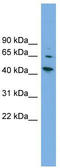 WAS/WASL Interacting Protein Family Member 2 antibody, TA340267, Origene, Western Blot image 