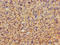 Dickkopf WNT Signaling Pathway Inhibitor 1 antibody, A64088-100, Epigentek, Immunohistochemistry paraffin image 