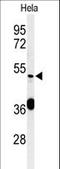 DEAD-Box Helicase 49 antibody, LS-C167337, Lifespan Biosciences, Western Blot image 