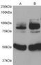 DCC-interacting protein 13-alpha antibody, TA302413, Origene, Western Blot image 