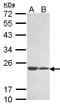 Membrane Anchored Junction Protein antibody, LS-C185829, Lifespan Biosciences, Western Blot image 