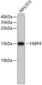Fatty Acid Binding Protein 4 antibody, 13-041, ProSci, Western Blot image 