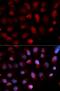 ETS Variant 4 antibody, LS-C335603, Lifespan Biosciences, Immunofluorescence image 
