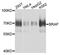 BRCA1 Associated Protein antibody, STJ111953, St John