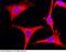 Ribosomal Protein S3 antibody, 101346-T38, Sino Biological, Immunohistochemistry paraffin image 