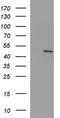 Fibrinogen Gamma Chain antibody, LS-C788460, Lifespan Biosciences, Western Blot image 