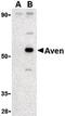 Cell death regulator Aven antibody, orb86679, Biorbyt, Western Blot image 
