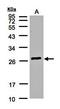 Glutathione S-transferase alpha-2 antibody, orb69801, Biorbyt, Western Blot image 