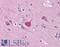 Bcl-2-related ovarian killer protein antibody, LS-B4703, Lifespan Biosciences, Immunohistochemistry frozen image 
