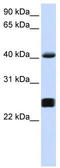 Serpin Family A Member 3 antibody, TA339986, Origene, Western Blot image 