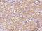 Coiled-Coil Domain Containing 91 antibody, 203721-T08, Sino Biological, Immunohistochemistry paraffin image 